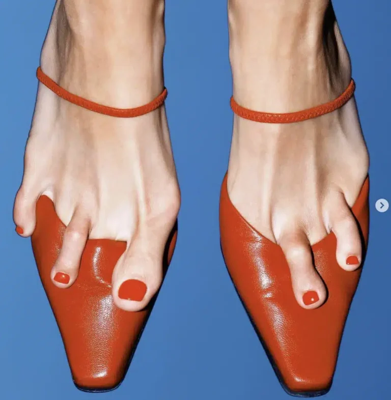 Questions fréquentes sur l’hallux valgus