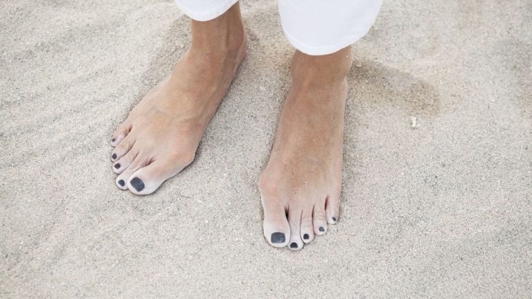 Chirurgie de l'hallux valgus : quelle est la meilleure saison pour programmer l’intervention ?