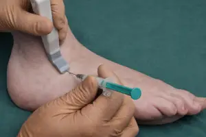 Infiltration du pied et de la cheville