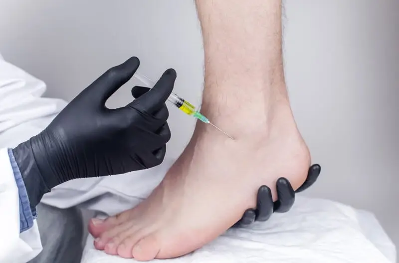 Infiltration du pied et de la cheville